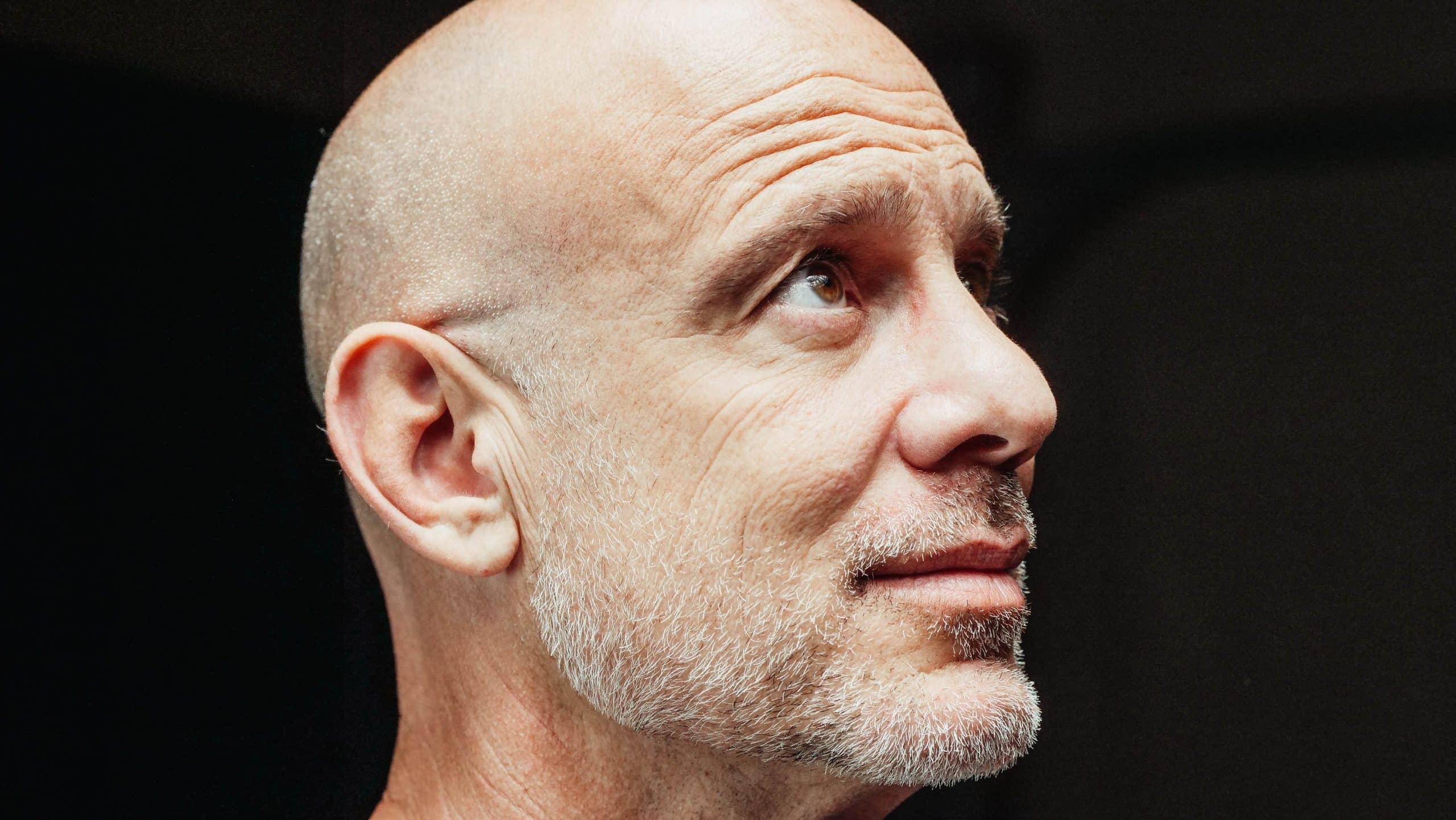 bald-man bald man