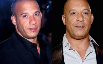 7 Celebrities Who are Rocking the Scalp Micropigmentation Look