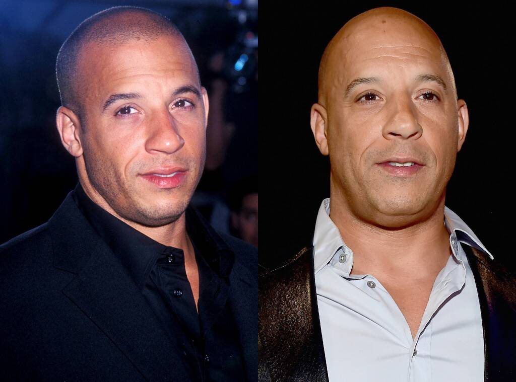vin-diesel-scalp-micropigmentation