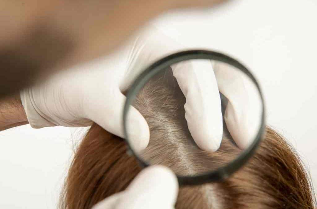 Everything you need to know about Scalp Micropigmentation for Women