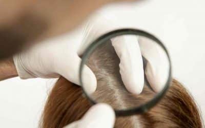 Everything you need to know about Scalp Micropigmentation for Women