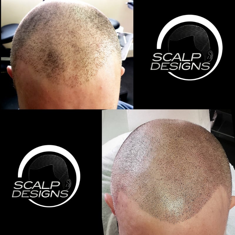 Polish_20221003_145054979 scalp shading
