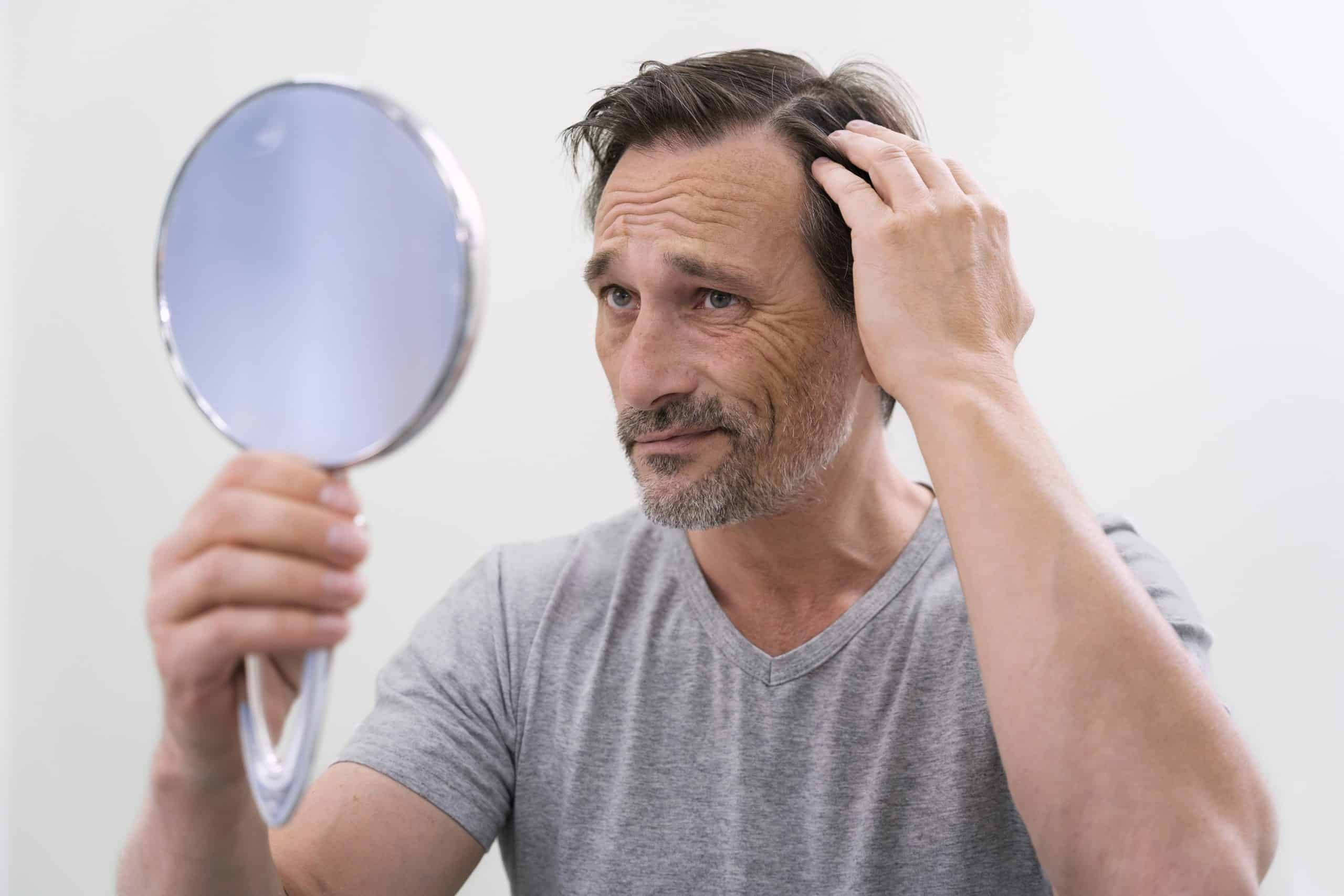 hair loss foods Hair Loss Foods