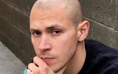 Embracing the Shaved Head Look with Confidence – Hair Loss Doesn’t Have to Hold You Back