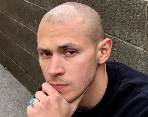 Embracing the Shaved Head Look with Confidence – Hair Loss Doesn’t Have to Hold You Back
