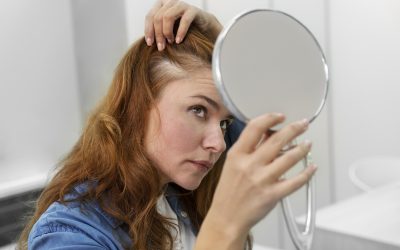 Hair Loss: Myths vs. Facts
