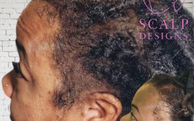 Scalp Micropigmentation for Black Women / Scalp Designs