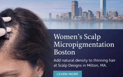 Thinning Hair Solution for Women in Boston | Women’s SMP | Scalp Designs
