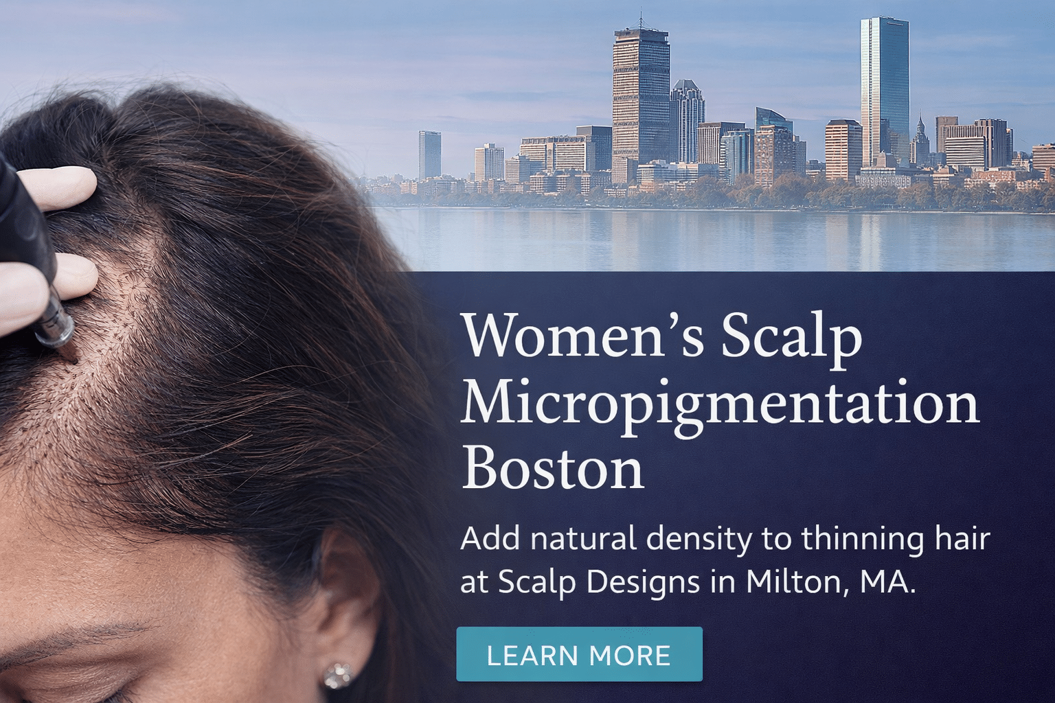 womens scalp micropigmentation at Scalp Designs Women’s scalp micropigmentation for thinning hair in Boston at Scalp Designs in Milton MA