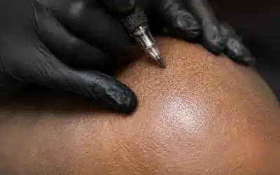 Why Professional Scalp Micropigmentation Uses Dots Instead of Lines