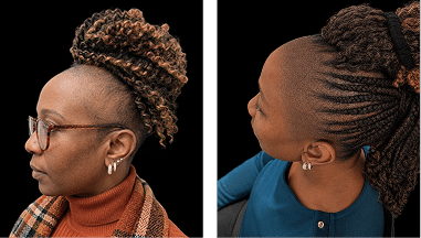 Full scalp restoration smp african american women scalp designs African American woman before and after scalp micropigmentation showing full scalp restoration, improved hair density, and natural-looking coverage.